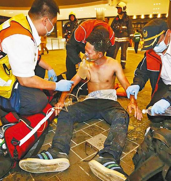 忍痛楚 一名受傷男子戴上氧氣罩接受初步治療，表情痛苦。